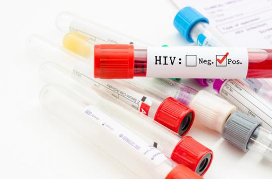 VIH : un Européen sur sept ignore sa séropositivité