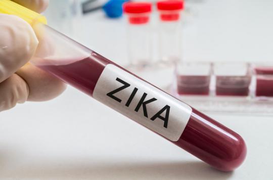 Zika :  un registre international pour recenser les femmes exposées