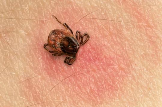 Maladie de Lyme : un plan pour éviter l'errance thérapeutique