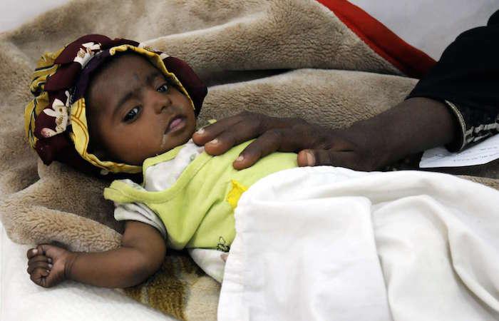 Yémen : plus de 460 000 enfants en danger de mort 