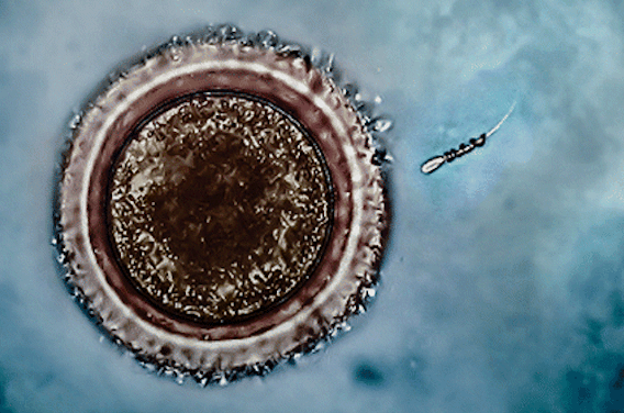 Fécondation in vitro : Spermbot guide les spermatozoïdes