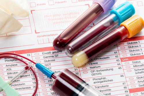 Dépression : des tests sanguins pour évaluer l’efficacité des traitements 