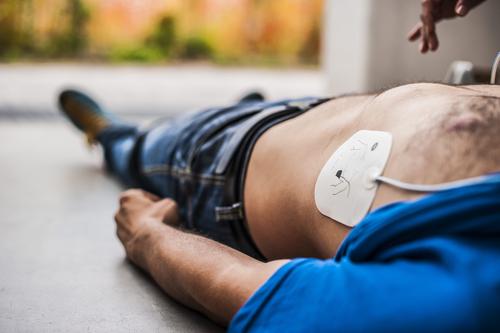 La présence de défibrillateurs dans les lieux publics améliore le taux de survie des victimes d'arrêt cardiaque 