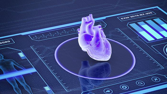 Troubles du rythme cardiaque réfractaires : 99% d’efficacité de la radiothérapie stéréotaxique