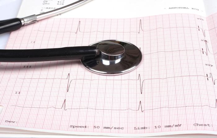 Les cardiologues en colère contre la baisse du nombre d’internes