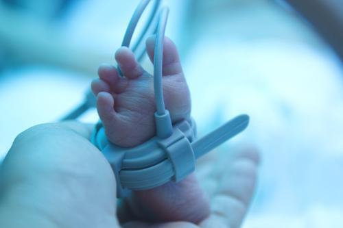 Syndrome du bébé secoué :  un nourrisson de cinq mois handicapé à 95 %