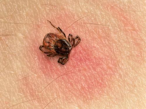 Maladie de Lyme :  150 patients dénoncent un manque de fiabilité des tests 