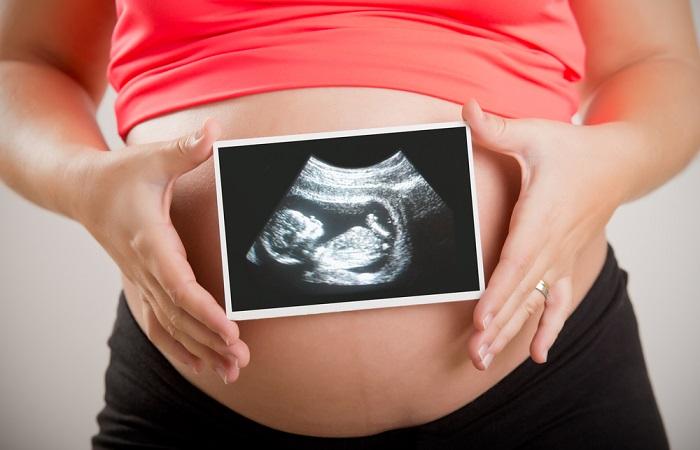 Un antiépileptique pendant la grossesse augmente le risque de bec de lièvre