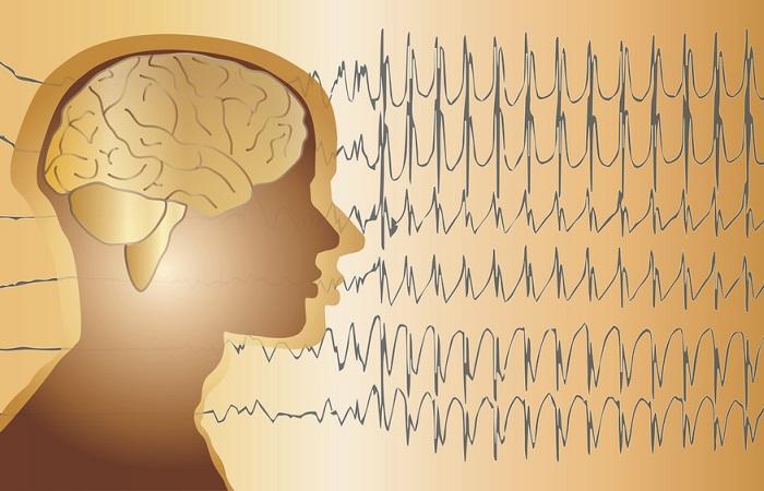 10 questions sur l’épilepsie