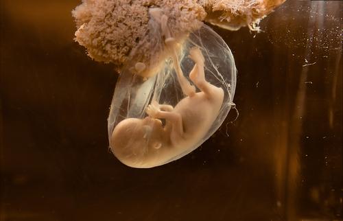Grossesse : la prise d'ibuprofène au 1er trimestre affecte la fertilité des petites filles