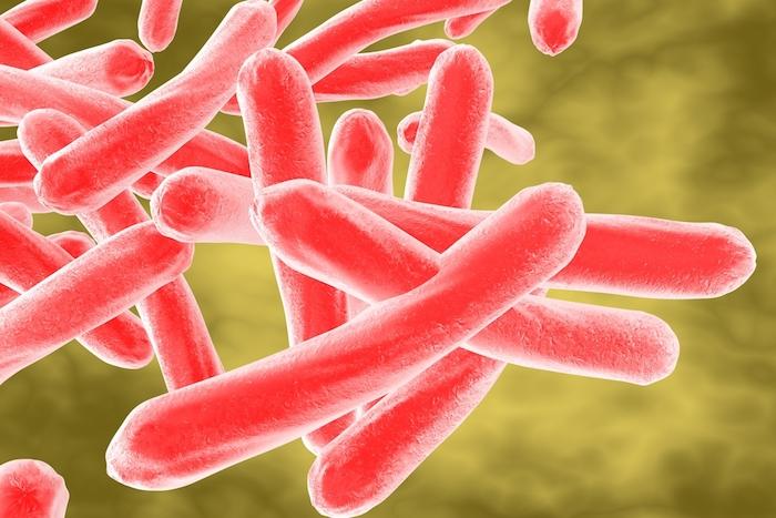 Tuberculose pulmonaire : un étudiant infecté peut contaminer 10 à 15 personnes
