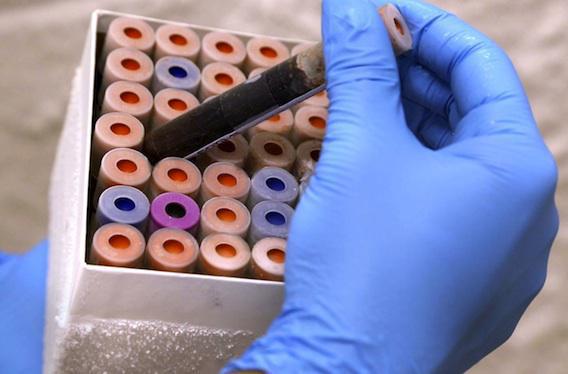 Un test sanguin pour déterminer si les antibiotiques sont nécessaires