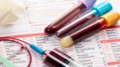 Dépression : des tests sanguins pour évaluer l’efficacité des traitements 