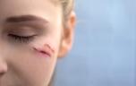Voici ce qui protège votre visage des cicatrices 