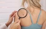 Immunothérapie dans le mélanome : les doses moins fortes seraient plus efficaces