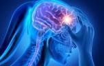 « La migraine chronique devrait être reconnue comme un véritable handicap »