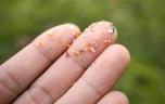 Des microplastiques dans le corps : un risque accru pour le foie ?
