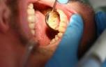Maladie parodontale : les statines pourraient réduire l’inflammation des gencives