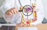 Cancer colorectal chez les jeunes: cette bactérie expliquerait l’explosion des cas