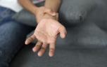 Des personnes tétraplégiques retrouvent l'usage de leurs mains grâce à des électrodes