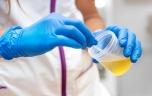 Autisme : bientôt un test urinaire capable de détecter le trouble ?