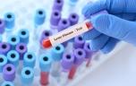 Maladie de Lyme : vers un meilleur diagnostic ? 