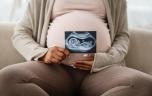 Intelligence, taille, longévité : jusqu'où ira la sélection génétique des futurs bébés ?