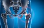 Fractures : les muscles cachent-ils un mécanisme protecteur ?