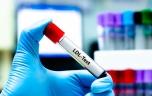 Cholestérol : le test classique est-il assez précis ?