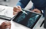 Arthrose du genou : ce que vous pouvez encore changer
