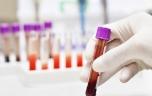 Un test sanguin révolutionnaire pour détecter plus de 50 cancers