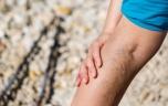 Varices des jambes : ces symptômes à ne pas négliger 