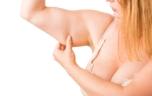 Fracture : avoir beaucoup de graisse au niveau des bras est mauvais signe 