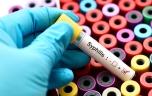 Syphilis : l’étude qui éclaire sur les origines de la maladie