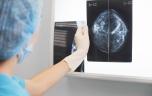 Cancer du sein : cette IA permet d'avoir un diagnostic dans la journée