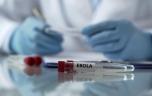 Nouvelle épidémie d’Ebola en RDC : quelle est la situation ?