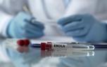Ebola : pourquoi certains survivants n’en ont pas fini avec la maladie ?