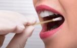 Cancer de la bouche : bientôt un dépistage salivaire en une heure ?