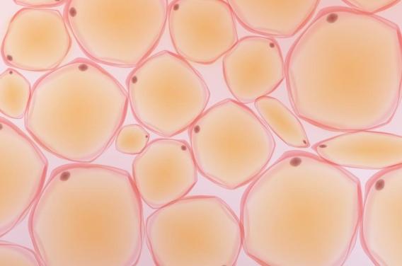 Obésité : cette découverte de  ...