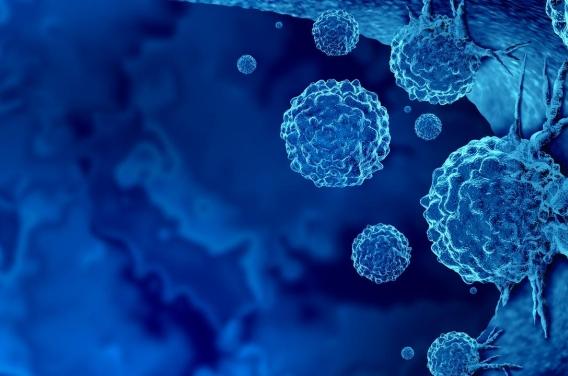 Cancers précoces : le vieillissement  ...