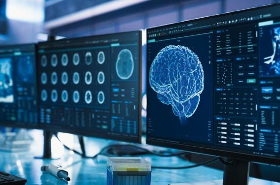 Mort de Nathalie Baye : pourquoi diagnostiquer la démence à corps de Lewy peut-il prendre des années ?