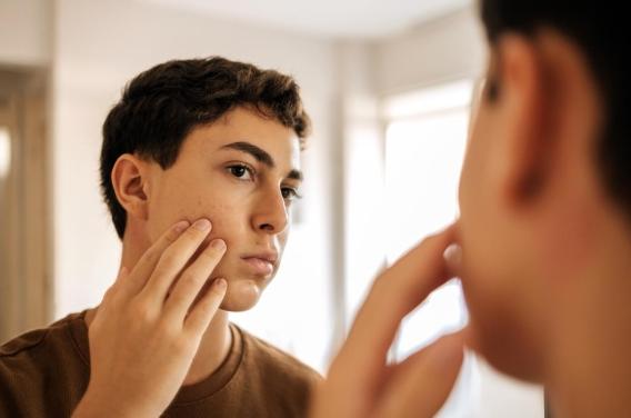 Looksmaxxing : jusqu'où certains jeunes sont-ils prêts à aller pour séduire ?