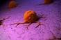 Cancer : la membrane qui entoure les tumeurs, une clé pour éviter les métastases ?