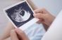 La pression dans l’utérus joue un rôle sur la formation du visage de votre bébé