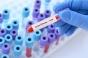 Maladie de Lyme : vers un meilleur diagnostic ? 