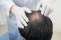 Analogues du GLP-1 : un effet inattendu sur les cheveux ?