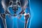 Fractures : les muscles cachent-ils un mécanisme protecteur ?