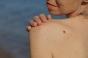 Grains de beauté : comment vérifier soi-même qu’ils ne sont pas cancéreux