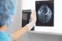 Cancer du sein : cette IA permet d'avoir un diagnostic dans la journée