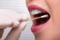 Cancer de la bouche : bientôt un dépistage salivaire en une heure ?